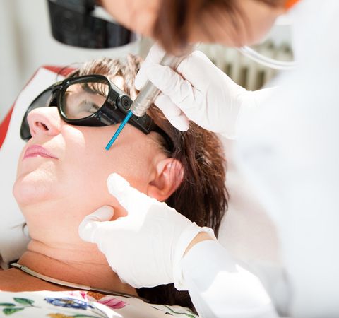 Laserbehandlung am Gesicht
