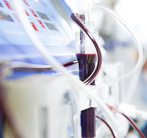 Blut in Dialysegerät