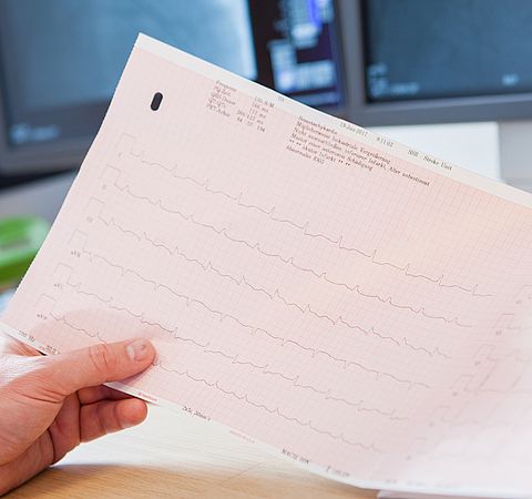 EKG auswertung