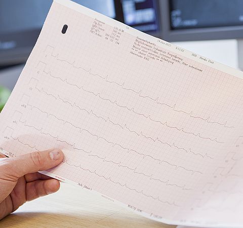 EKG Auswertung